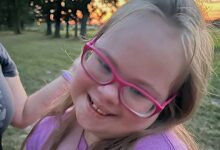 down syndrome