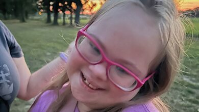 down syndrome