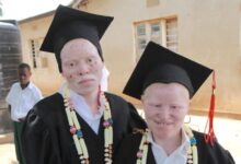 albinism