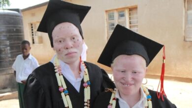 albinism